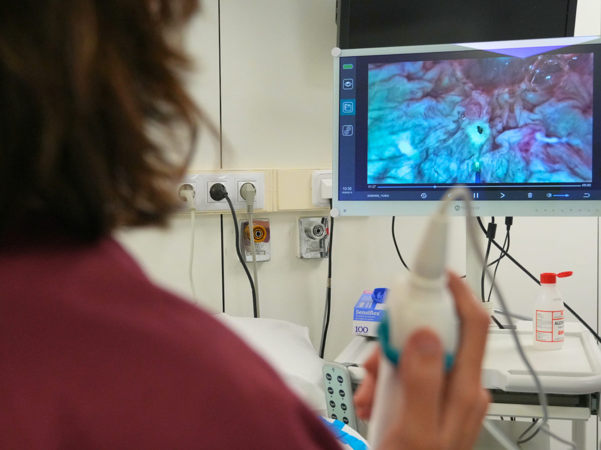 L’Hospital Joan XXIII inicia un tractament amb làser per a tumors vesicals que evita passar per quiròfan