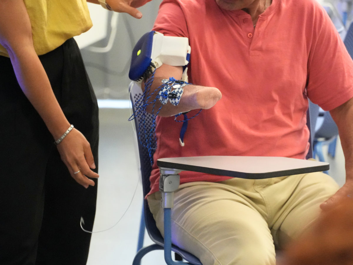 L’Hospital Joan XXIII reforça el tractament del dolor de membre fantasma
