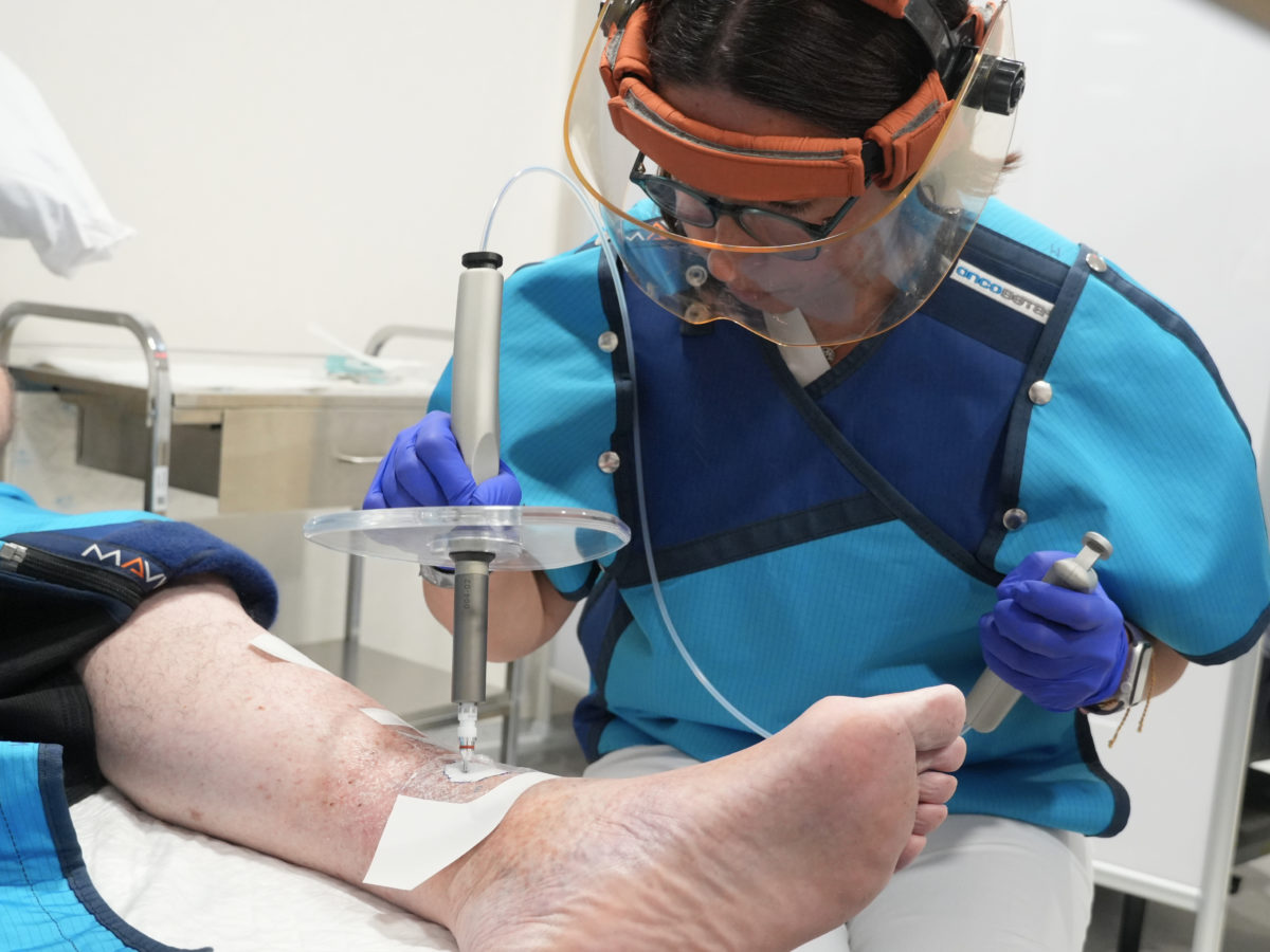 L’Hospital Joan XXIII i l’IDI incorporen un nou tractament per a determinats càncers de pell